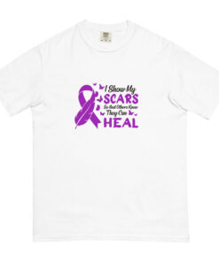 Alternative view of I Show My Scars