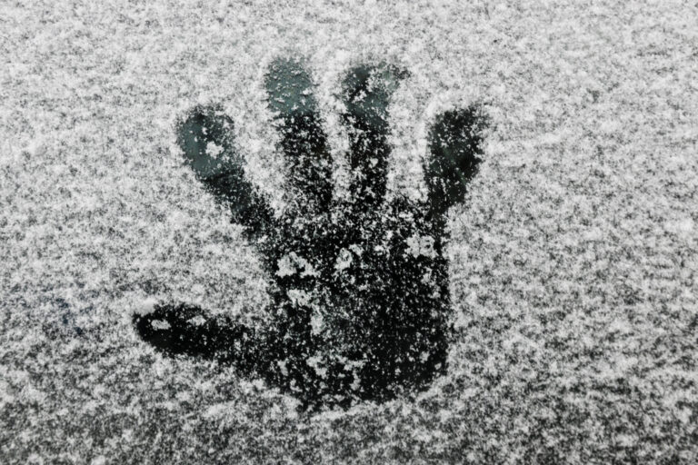 The Hippocampus Freeze: The Hidden Physical Toll of Toxic Bonds